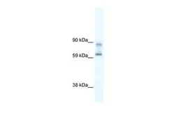 Anti-DDX42 antibody, N-term used in Western Blot (WB). GTX47520