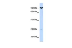 Anti-SUPV3L1 antibody, N-term used in Western Blot (WB). GTX47525