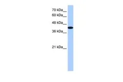 Anti-AKAP7 antibody, Internal used in Western Blot (WB). GTX47527