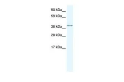 Anti-AKAP7 antibody, Internal used in Western Blot (WB). GTX47528