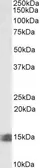 Anti-INCA antibody, C-term used in Western Blot (WB). GTX47540