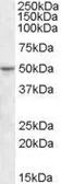 Anti-TEF4 antibody, Internal used in Western Blot (WB). GTX47542