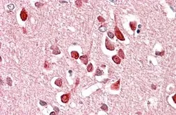 Anti-UNC5C antibody, Internal used in IHC (Paraffin sections) (IHC-P). GTX47544