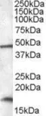 Anti-RBM3 antibody, C-term used in Western Blot (WB). GTX47550