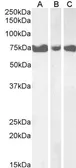 Anti-IP3KC antibody, Internal used in Western Blot (WB). GTX47572