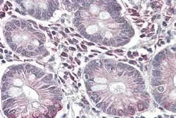 Anti-ASBT antibody, C-term used in IHC (Paraffin sections) (IHC-P). GTX47585