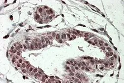 Anti-TREX2 antibody, Internal used in IHC (Paraffin sections) (IHC-P). GTX47594