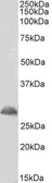 Anti-TREM2 antibody, Internal used in Western Blot (WB). GTX47596