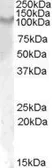 Anti-IL17 Receptor alpha antibody, Internal used in Western Blot (WB). GTX47598