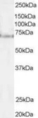 Anti-Pescadillo antibody used in Western Blot (WB). GTX47602
