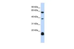 Anti-HTR3E antibody, Internal used in Western Blot (WB). GTX47615