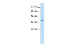 Anti-KCNAB2 antibody, C-term used in Western Blot (WB). GTX47628