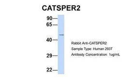 Anti-CATSPER2 antibody, N-term used in Western Blot (WB). GTX47631