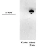 Anti-KCNN3 antibody, C-term used in Western Blot (WB). GTX47693