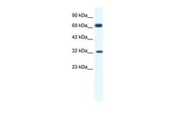 Anti-KCNN1 antibody, C-term used in Western Blot (WB). GTX47694