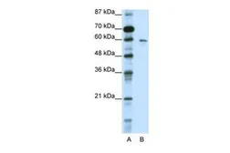 Anti-KCNG1 antibody, N-term used in Western Blot (WB). GTX47696