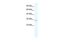 Anti-CLIC2 antibody, C-term used in Western Blot (WB). GTX47699