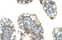 Anti-PARP6 antibody, C-term used in IHC (Paraffin sections) (IHC-P). GTX47710