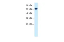 Anti-KIF19 antibody, N-term used in Western Blot (WB). GTX47711