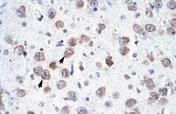 Anti-RALY antibody, N-term used in IHC (Paraffin sections) (IHC-P). GTX47714