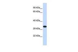 Anti-KIF25 antibody, N-term used in Western Blot (WB). GTX47717