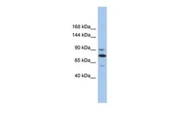 Anti-MKLP1 antibody, Internal used in Western Blot (WB). GTX47725