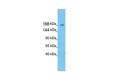 Anti-KIF21A antibody, N-term used in Western Blot (WB). GTX47728