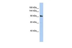 Anti-MKLP1 antibody, Internal used in Western Blot (WB). GTX47732