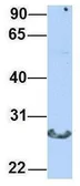 Anti-CTRL antibody, N-term used in Western Blot (WB). GTX47741