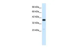 Anti-C4 binding protein B antibody, N-term used in Western Blot (WB). GTX47750
