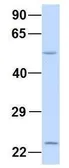 Anti-XK antibody, N-term used in Western Blot (WB). GTX47751