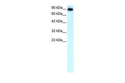 Anti-Band3 antibody, N-term used in Western Blot (WB). GTX47753