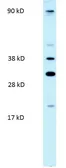 Anti-PARP11 antibody, N-term used in Western Blot (WB). GTX47755