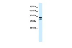 Anti-PARP6 antibody, N-term used in Western Blot (WB). GTX47757