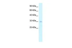 Anti-Claudin 15 antibody, C-term used in Western Blot (WB). GTX47760