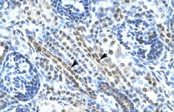 Anti-ANKRD11 antibody, N-term used in IHC (Paraffin sections) (IHC-P). GTX47768