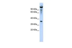 Anti-Ribonuclease T2 antibody, Internal used in Western Blot (WB). GTX47771
