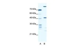 Anti-NFS1 antibody, Internal used in Western Blot (WB). GTX47774