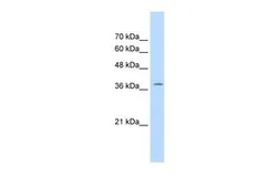 Anti-RALY antibody, C-term used in Western Blot (WB). GTX47776