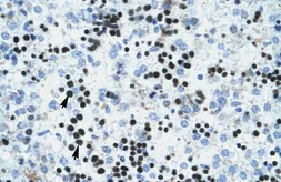 Anti-IVNS1ABP antibody, N-term used in IHC (Paraffin sections) (IHC-P). GTX47777