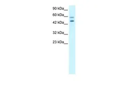 Anti-Vasculin antibody, N-term used in Western Blot (WB). GTX47780