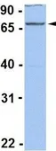 Anti-ACSL1 antibody, C-term used in Western Blot (WB). GTX47782