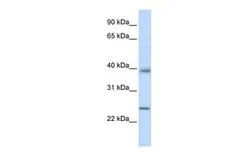 Anti-Claudin 7 antibody, C-term used in Western Blot (WB). GTX47786