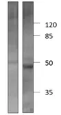 Anti-CTGF antibody used in Western Blot (WB). GTX47807