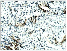 Anti-Aquaporin 8 antibody used in IHC (Paraffin sections) (IHC-P). GTX47812