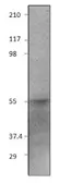 Anti-E2F2 antibody used in Western Blot (WB). GTX47813