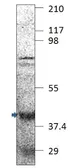 Anti-FBXO32 antibody used in Western Blot (WB). GTX47819