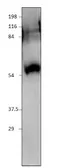 Anti-SIDT1 antibody used in Western Blot (WB). GTX47824
