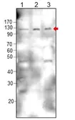 Anti-DCC antibody used in Western Blot (WB). GTX47825