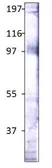 Anti-STRA6 antibody used in Western Blot (WB). GTX47857